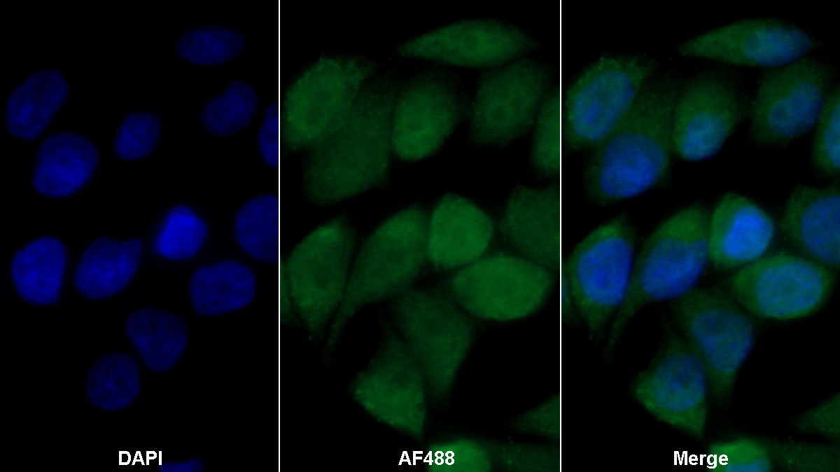 Polyclonal Antibody to Von Willebrand Factor Cleaving Protease (vWFCP)