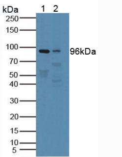 Polyclonal Antibody to Protein Tyrosine Phosphatase Receptor Type N (PTPRN)