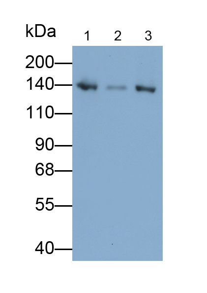 Polyclonal Antibody to Procollagen I N-Terminal Propeptide (PINP)