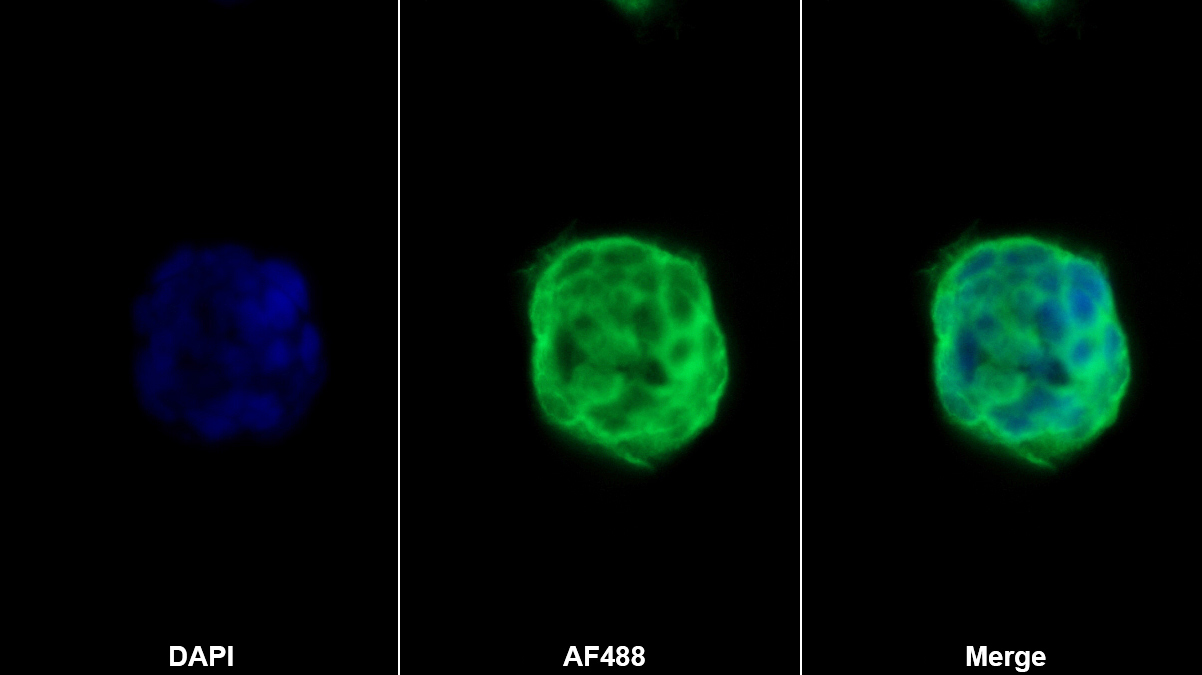 Polyclonal Antibody to Alpha-2-Macroglobulin Like Protein 1 (a2ML1)