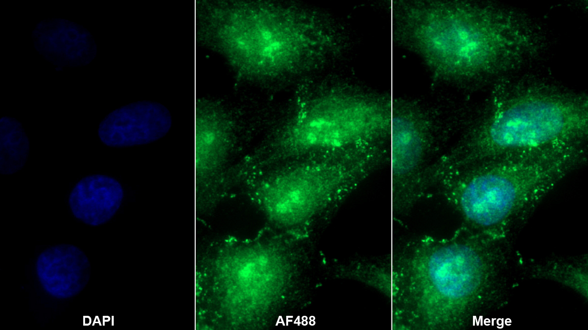 Polyclonal Antibody to Retinoic Acid Receptor Alpha (RARa)