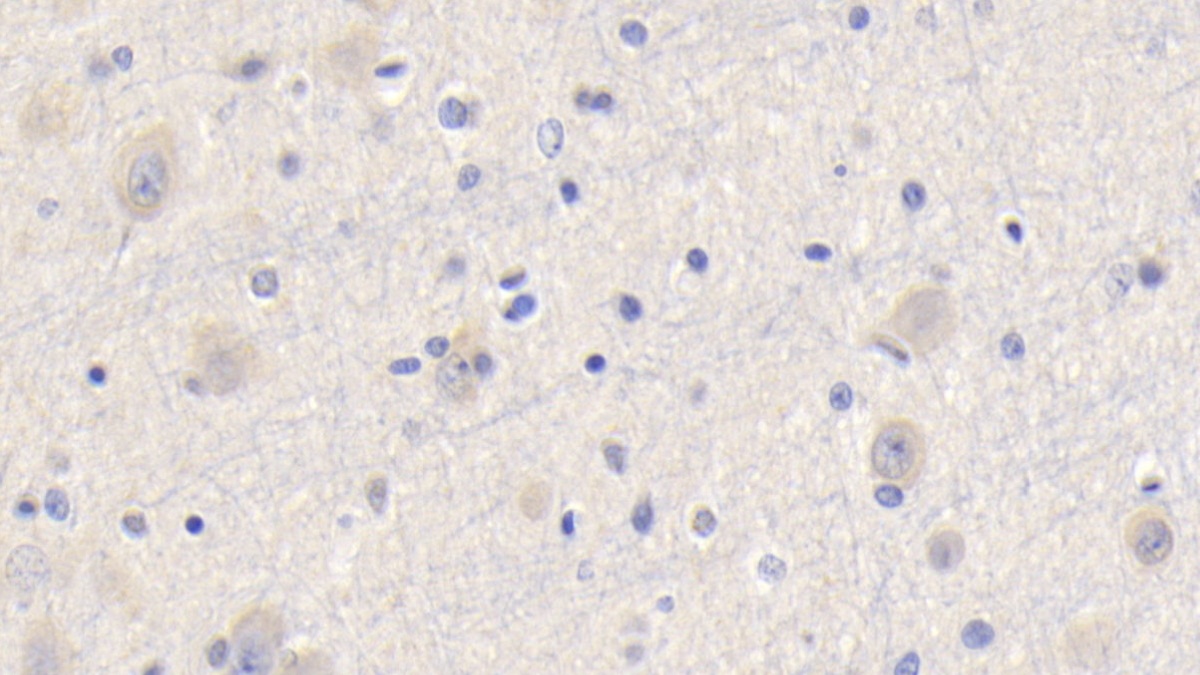 Polyclonal Antibody to Cyclophilin A (CYPA)