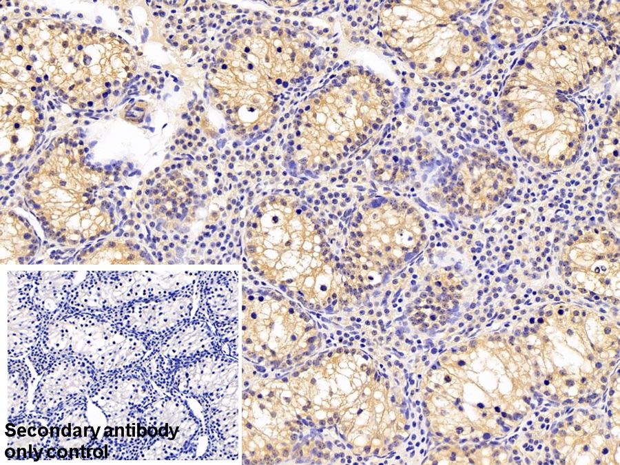 Polyclonal Antibody to Cyclophilin A (CYPA)