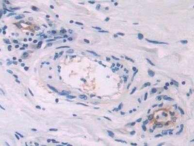 Polyclonal Antibody to Endoglin (ENG)