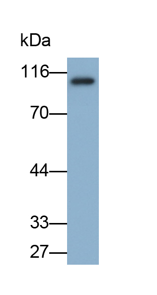 Polyclonal Antibody to Endoglin (ENG)