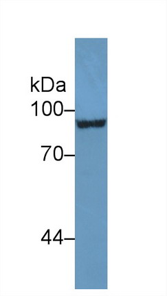 Polyclonal Antibody to Endoglin (ENG)