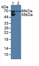 Polyclonal Antibody to Endoglin (ENG)