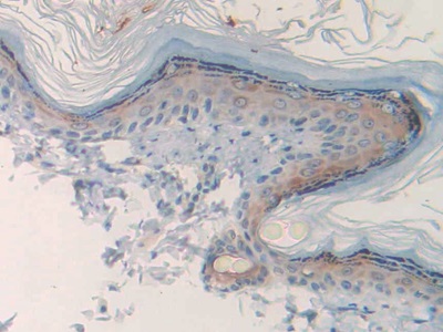 Polyclonal Antibody to Cholinergic Receptor, Muscarinic 1 (CHRM1)