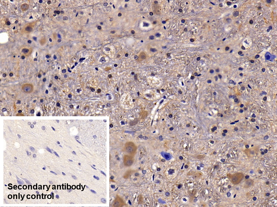 Polyclonal Antibody to Cholinergic Receptor, Muscarinic 1 (CHRM1)