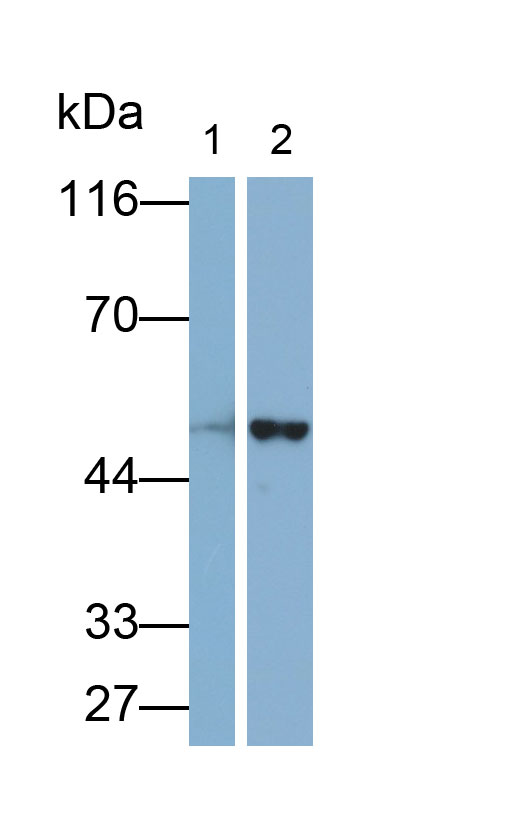 Polyclonal Antibody to Cytochrome P450 2E1 (CYP2E1)