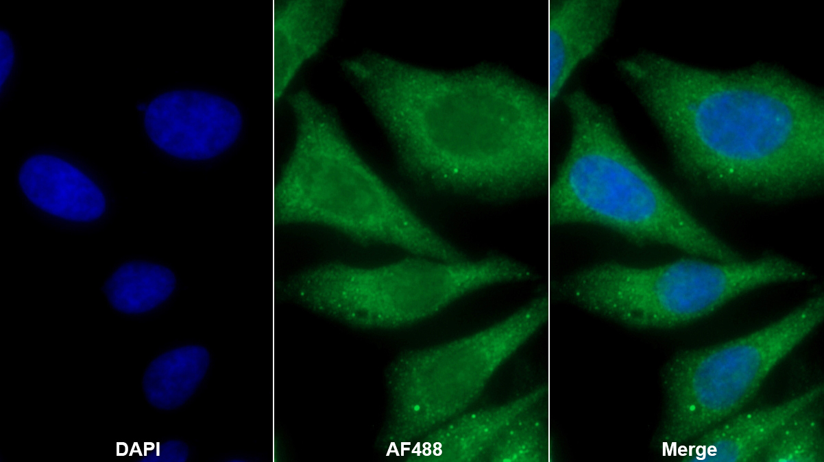 Polyclonal Antibody to Protein Zero, Myelin (MPZ)