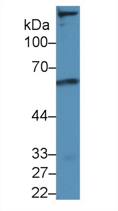 Polyclonal Antibody to Low Density Lipoprotein Receptor (LDLR)