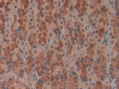 Polyclonal Antibody to Low Density Lipoprotein Receptor (LDLR)