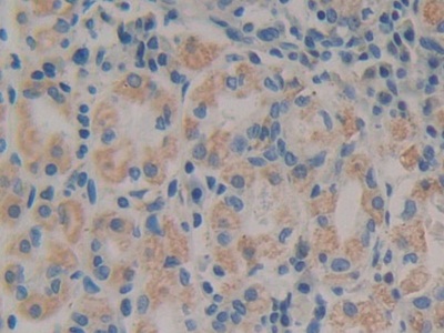 Polyclonal Antibody to Very Low Density Lipoprotein Receptor (VLDLR)