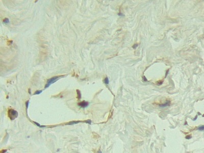 Polyclonal Antibody to Placental Cadherin (P-cadherin)