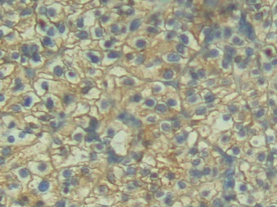 Polyclonal Antibody to Placental Cadherin (P-cadherin)