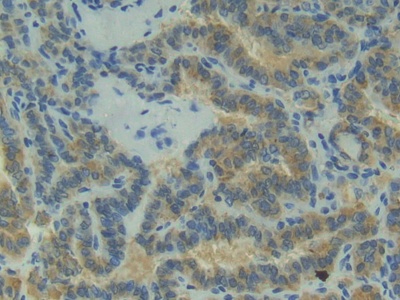 Polyclonal Antibody to Placental Cadherin (P-cadherin)