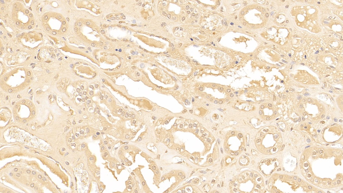 Polyclonal Antibody to Alpha-1-Antichymotrypsin (a1ACT)