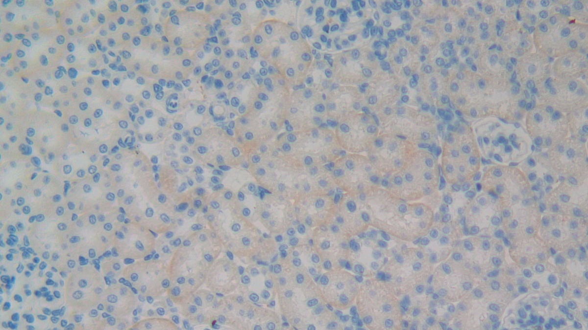 Polyclonal Antibody to Platelet Glycoprotein Ib Beta Chain (GP1BB)