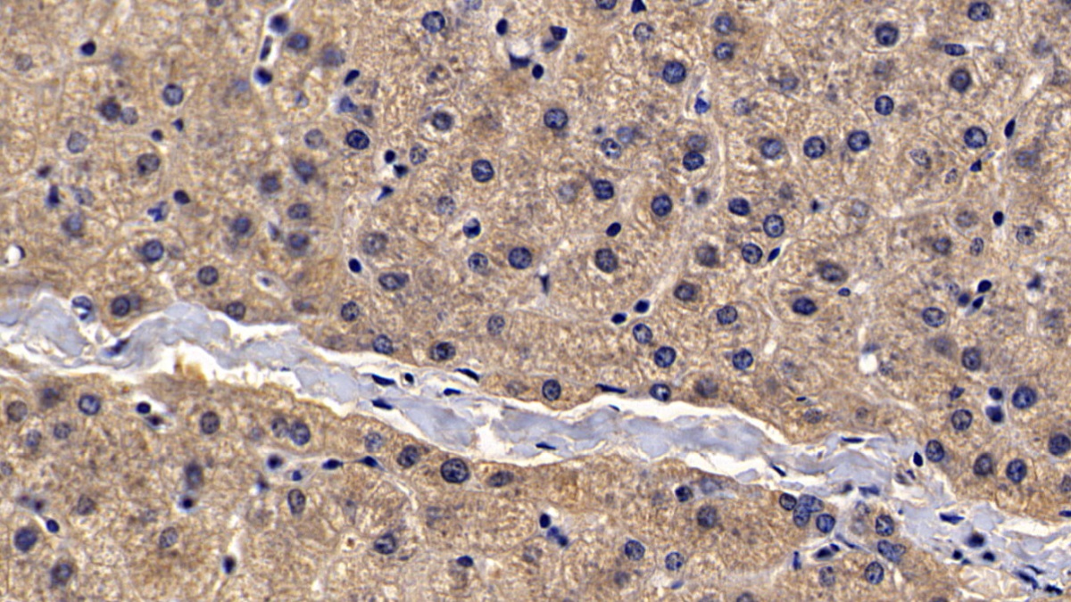 Polyclonal Antibody to Alpha-2-Macroglobulin (a2M)