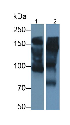 Polyclonal Antibody to Alpha-2-Macroglobulin (a2M)