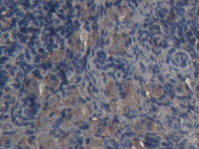 Polyclonal Antibody to Alpha-2-Macroglobulin (a2M)