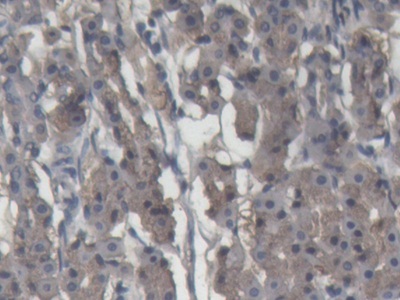 Polyclonal Antibody to Alpha-2-Macroglobulin (a2M)