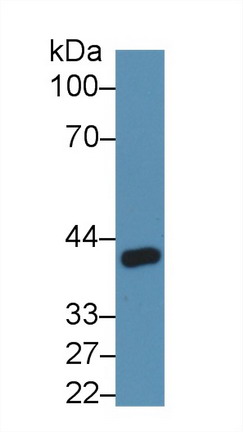 Polyclonal Antibody to Angiopoietin Like Protein 4 (ANGPTL4)