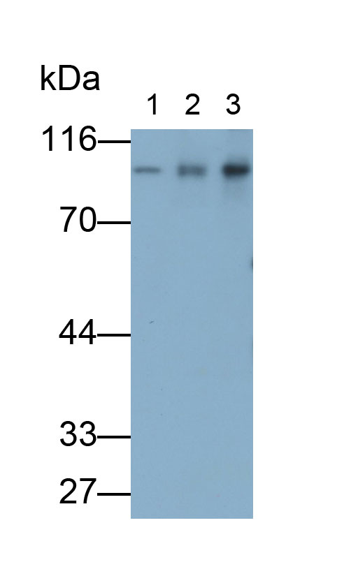 Polyclonal Antibody to Beta Catenin (β-catenin)