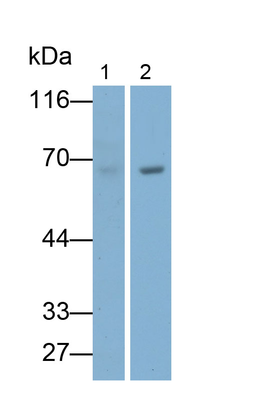 Polyclonal Antibody to Albumin (ALB)