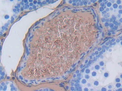 Polyclonal Antibody to Albumin (ALB)