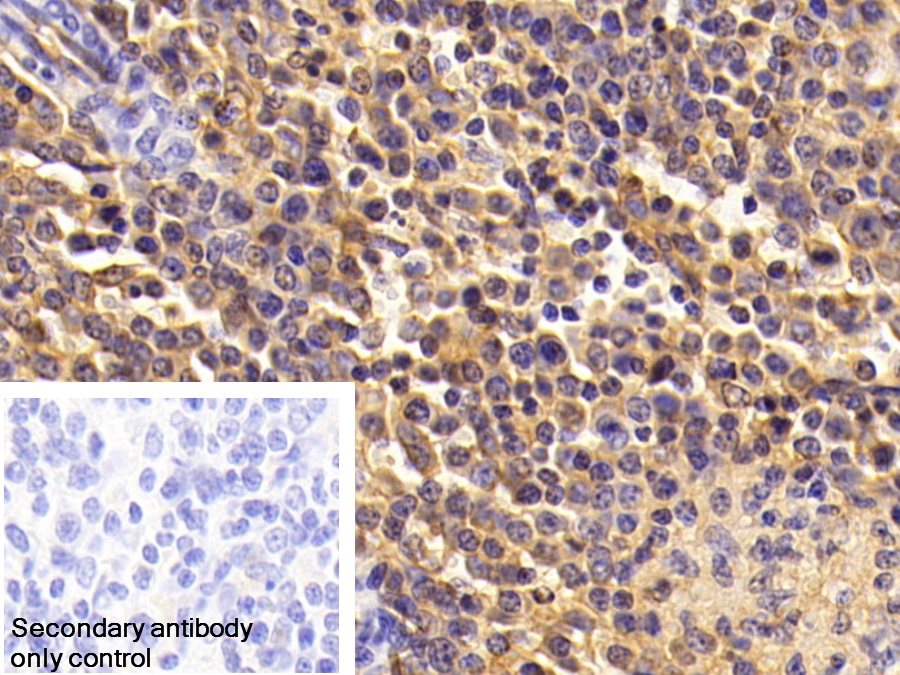 Polyclonal Antibody to Albumin (ALB)