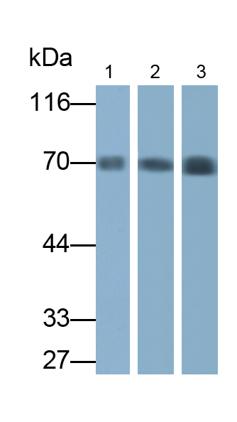 Polyclonal Antibody to Albumin (ALB)
