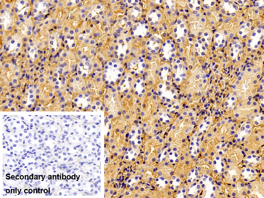 Polyclonal Antibody to Albumin (ALB)
