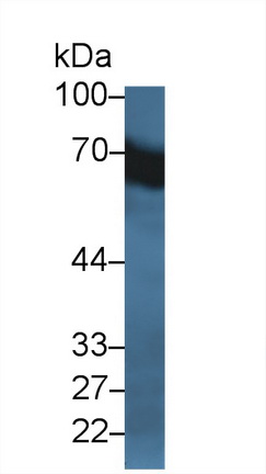 Polyclonal Antibody to Albumin (ALB)