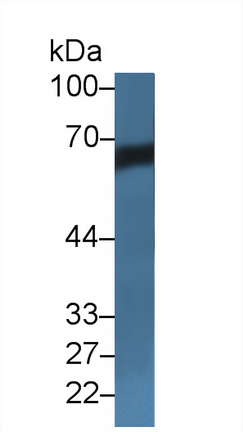 Polyclonal Antibody to Albumin (ALB)