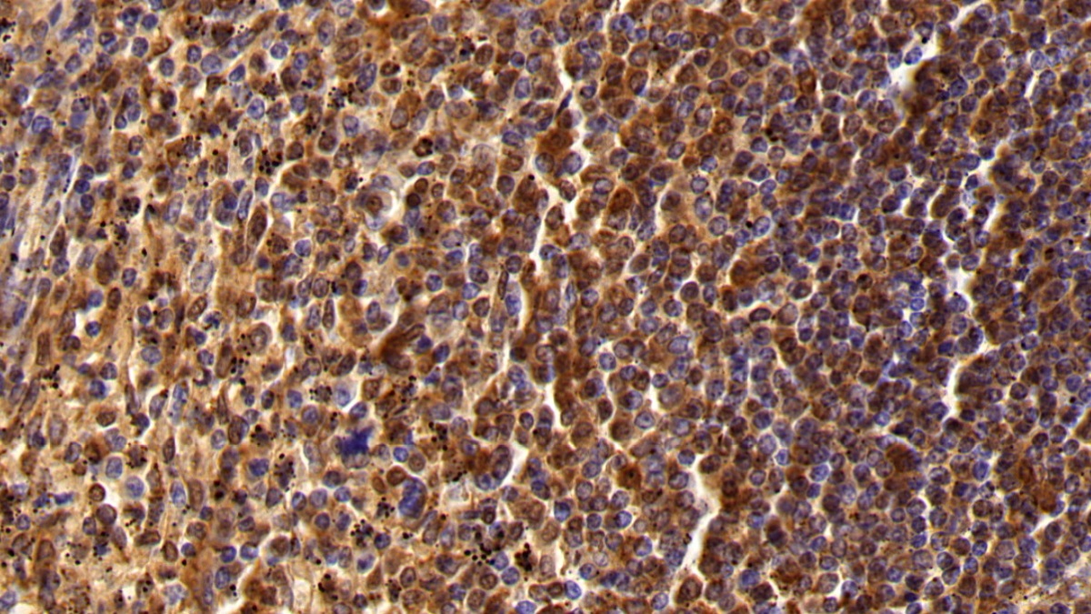 Polyclonal Antibody to Protein Tyrosine Phosphatase Receptor Type C (CD45)