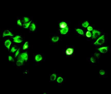 Polyclonal Antibody to Vimentin (VIM)