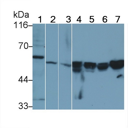 Polyclonal Antibody to Vimentin (VIM)