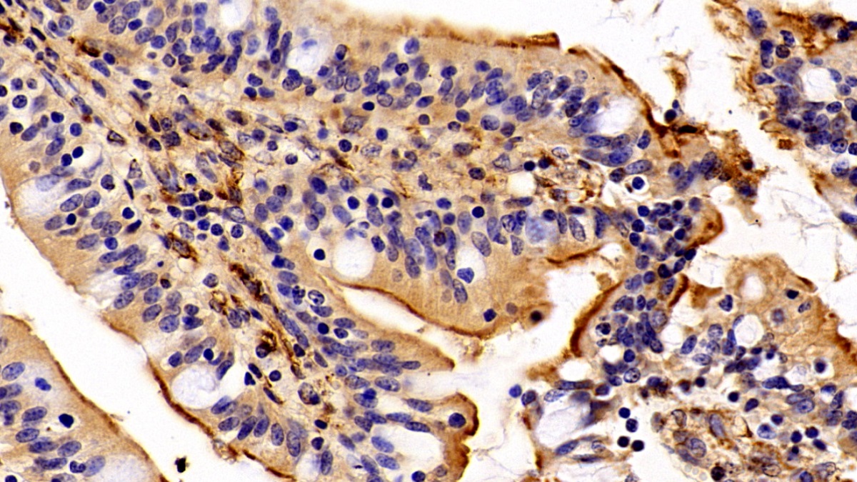 Polyclonal Antibody to Vimentin (VIM)