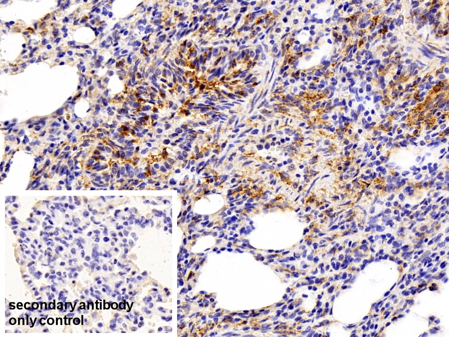 Polyclonal Antibody to Vimentin (VIM)