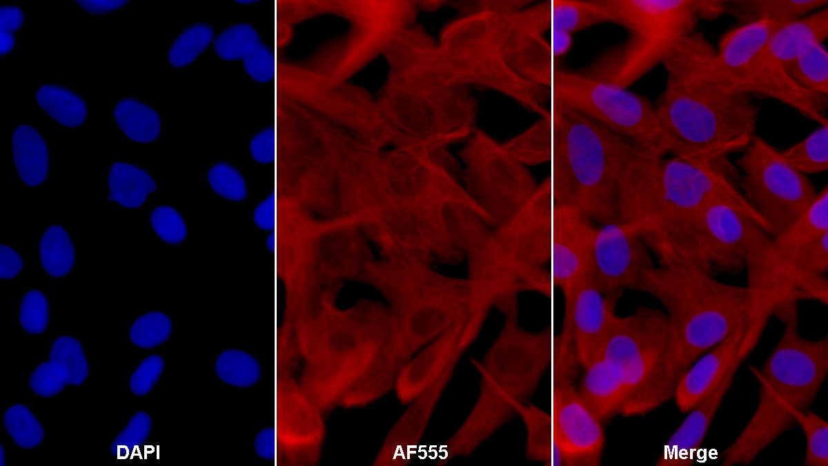 Polyclonal Antibody to Vimentin (VIM)