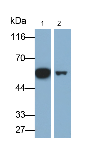 Polyclonal Antibody to Vimentin (VIM)