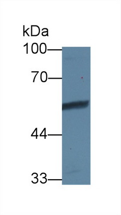 Polyclonal Antibody to Vitronectin (VTN)