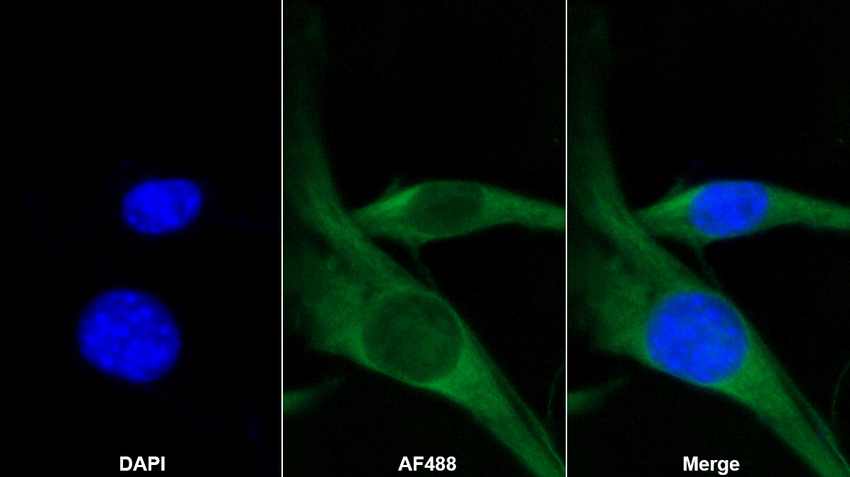 Polyclonal Antibody to Vitronectin (VTN)