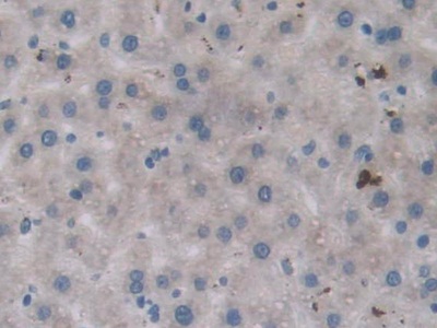 Polyclonal Antibody to Protein Tyrosine Phosphatase Receptor Type B (PTPRB)