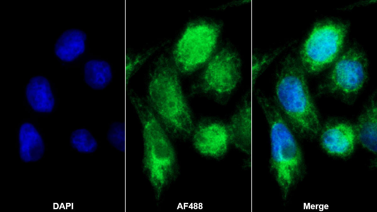 Polyclonal Antibody to Trefoil Factor 1 (TFF1)