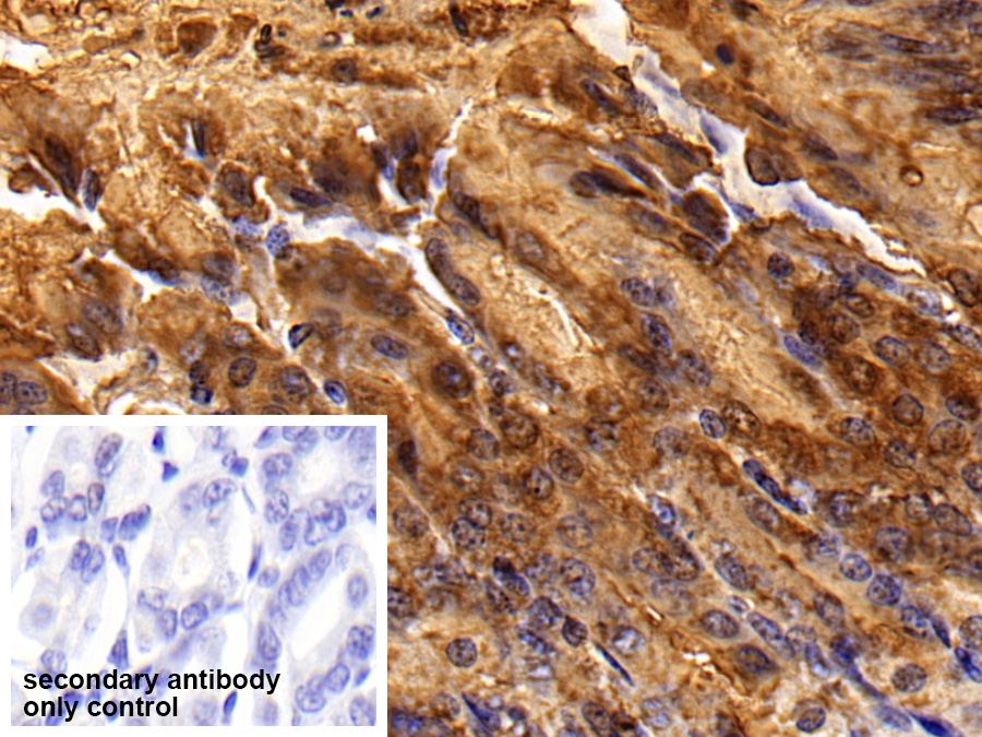 Polyclonal Antibody to Trefoil Factor 1 (TFF1)