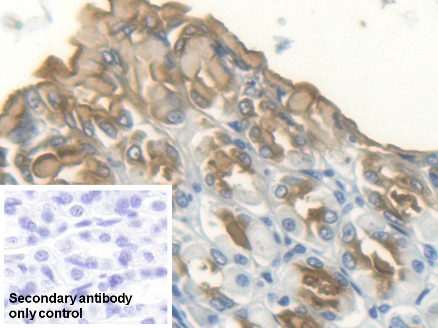 Polyclonal Antibody to Trefoil Factor 1 (TFF1)