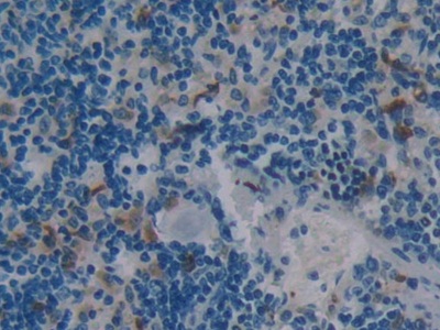 Polyclonal Antibody to Cytochrome P450 7A1 (CYP7A1)